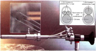 Рис. 36-6. Нейроэндоскоп «Decq» («Karl Storz», Германия) в сборе (головная часть).