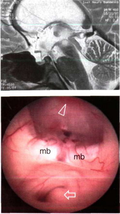 Рис. 37-6. Рентгеновская и эндоскопическая анатомия структур дна и задних отделов